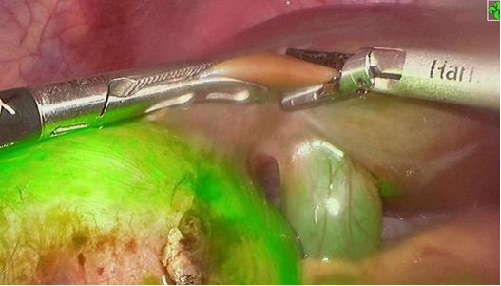 640 (4).png 640 (4).png